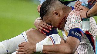 Kylian Mbappé (France) reçoit un traitement après s'être blessé lors d'un match du groupe D entre l'Autriche et la France à l'Euro 2024 de football à Düsseldorf, en Allemagne