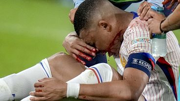 Килиан Мбаппе получил травму носа в первом матче Евро-2024