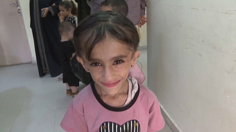 صورة مأخوذة من مقطع فيديو للطفلة جوري المصابة بورم في النخاع