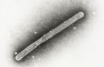 This 2005 electron microscope image shows an avian influenza A H5N1 virion.