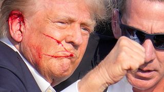 المرشح الجمهوري للرئاسة الأمريكية دونالد ترامب والدم ينزف من أذنه بعد محاولة اغتياله خلال حفل انتخابي في بنسلفانيا 