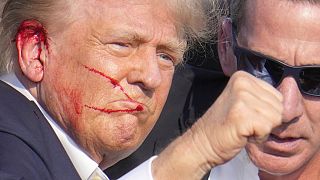 Donald Trump ferito