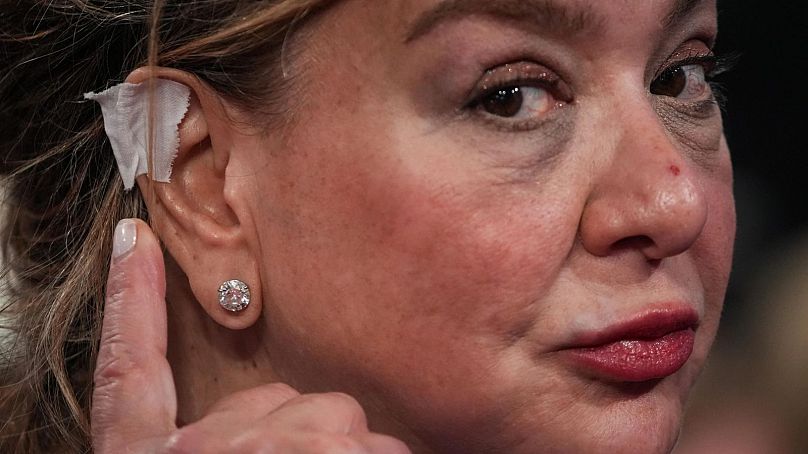 A Trump supporter points to her "bandaged" ear on the second day of the RNC on 16 July in Milwaukee