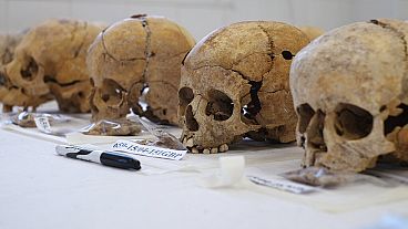 Crani appartenenti a scheletri di ciprioti, ritrovati nell'ambito della ricerca delle persone scomparse in seguito all'invasione turca del '74 e a precedenti conflitti