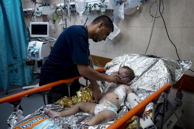 Palestinian Child Siwar Abdel-Hadi, 2, wounded in the Israeli bombardment of the Gaza Strip, receives medical treatment at a hospital in Deir al-Balah, Wednesday, July 24,2024