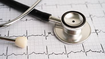 A stethoscope and an electrocardiogram.