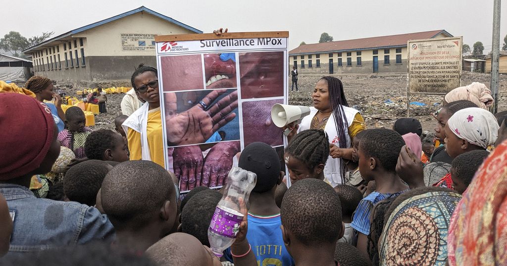 DRC : Teams in Goma race to identify rising mpox cases