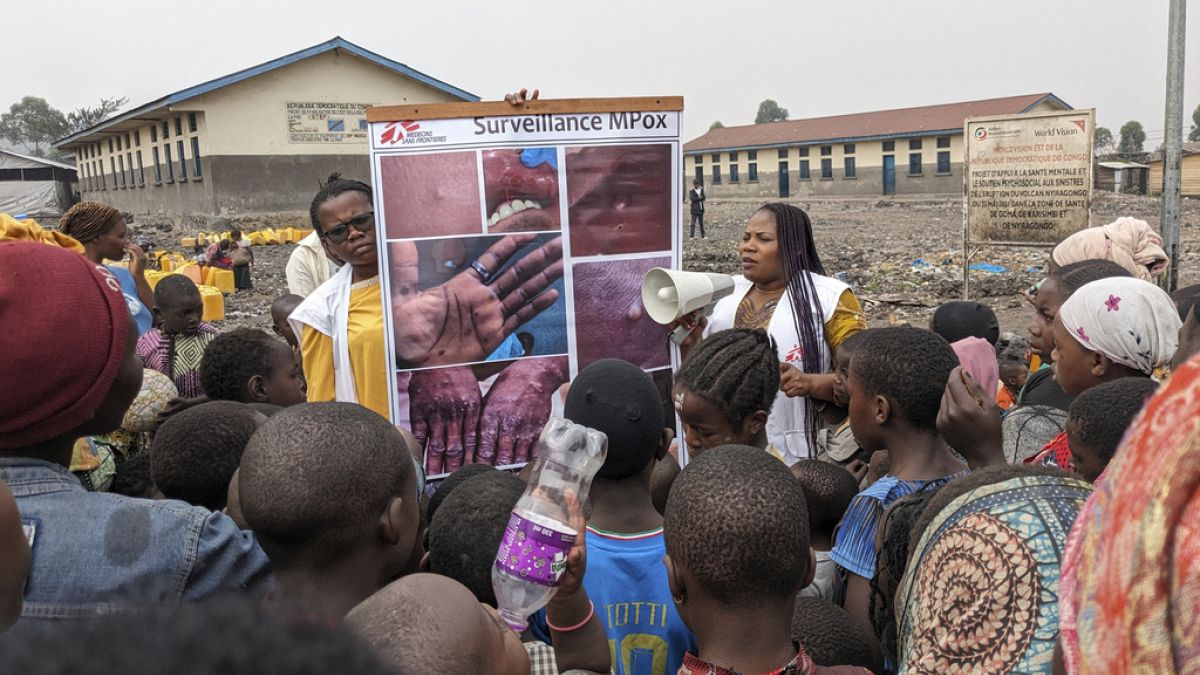 Fotografia fornecida por MSF (Médicos Sem Fronteiras), datada de 31 de maio de 2023, mostra profissionais de saúde a educar crianças sobre os sintomas da varíola em Goma,