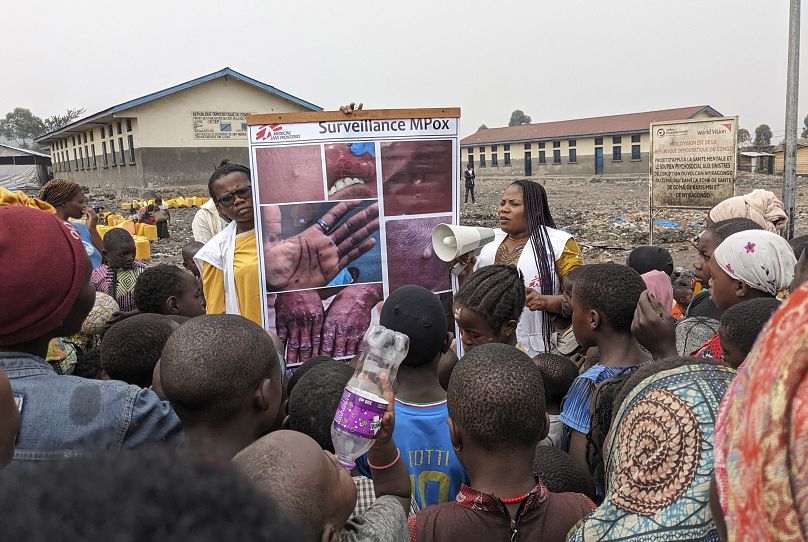 Cette photo fournie par Médecins sans frontières, datée du 31 mai 2023, montre des agents de santé éduquant des enfants sur les symptômes du mpox à Goma, au Congo.