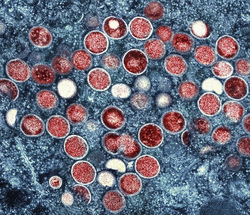 This image shows a colorised transmission electron micrograph of mpox particles (red) found within an infected cell (blue).