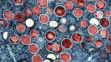 This image shows a colorised transmission electron micrograph of monkeypox particles (red) found within an infected cell (blue).