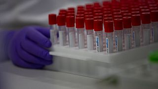 A lab technician moves a case of test tubes while conducting research on coronavirus, COVID-19, at Johnson & Johnson subsidiary Janssen Pharmaceutical in Belgium, June 2020.