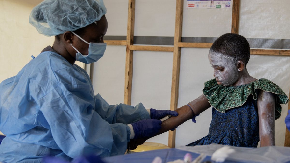 EU rules out mpox border controls and common vaccination plan