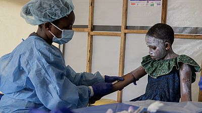 A health worker attends to a mpox patient, at a treatment centre in Munigi, eastern Congo