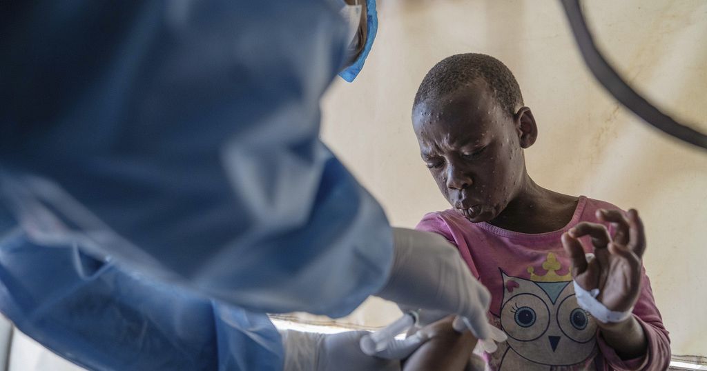 Africa’s health agency says could start mpox vaccinations within days