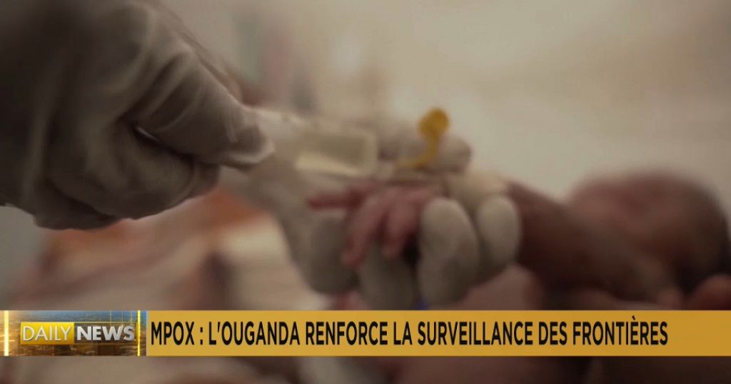 Uganda strengthens border surveillance to prevent Mpox outbreak