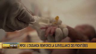 Uganda strengthens border surveillance to prevent Mpox outbreak 