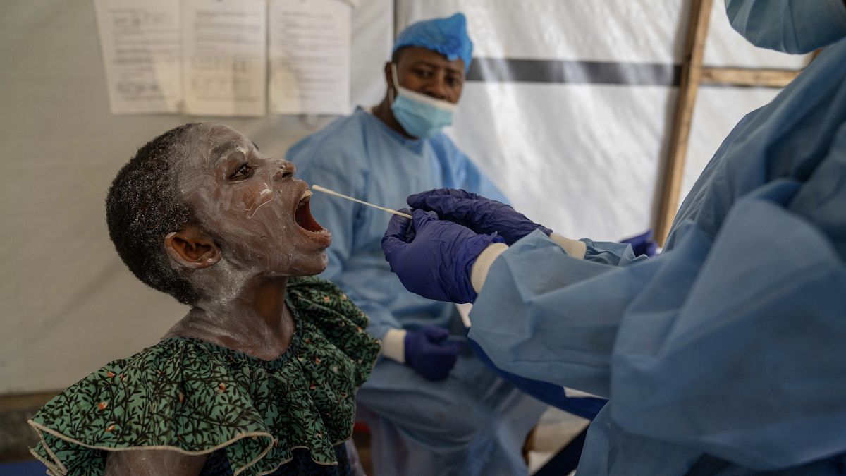 Will mpox trigger a new global pandemic? Experts agree it's 'concerning' but not COVID