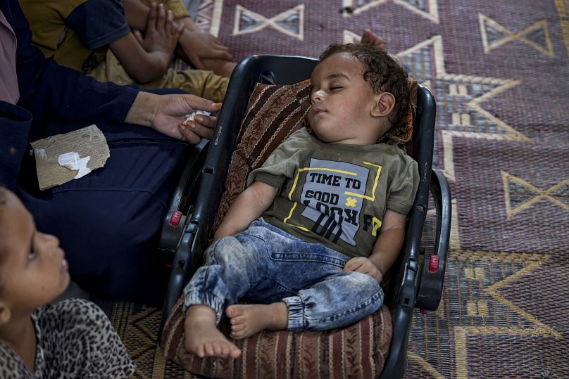 11-month-old Abdel-Rahman Abu El-Jedian, who suffers from polio, sleeps at a makeshift tent camp in Deir al-Balah.