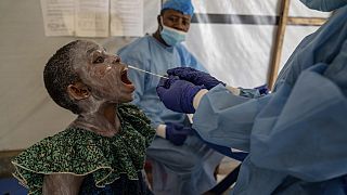 Mpox outbreak: DR Congo faces severe medicine shortages and overcrowding