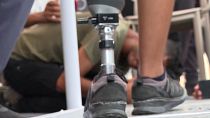 Man walks with new prosthesis for first time