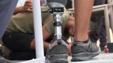 Man walks with new prosthesis for first time