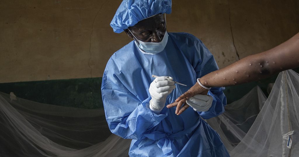 WHO reports almost 30,000 suspected mpox cases in Africa since the start of the year