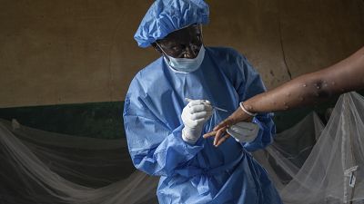 Atumisi Anaclet treats a sex worker with mpox on Sept. 4, 2024, in a hospital in Kamituga, in eastern Congo's South Kivu province.