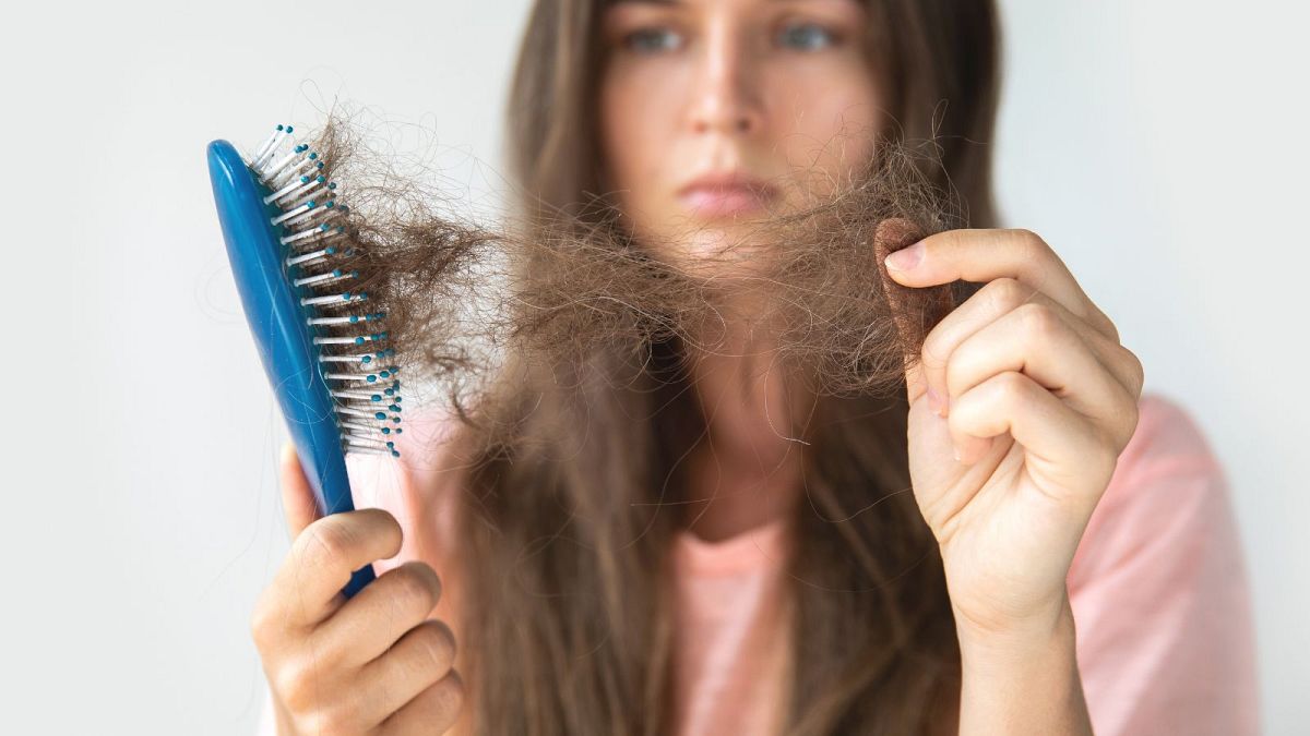 'It’s like I haven’t been the same person since': Why is female hair loss still so misunderstood?