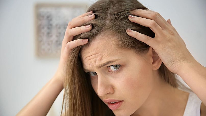 The mental toll of female hair loss can be most difficult.