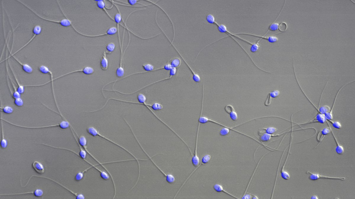 Proteins on sperm form a 'key' allowing it to fuse with an egg, new study finds