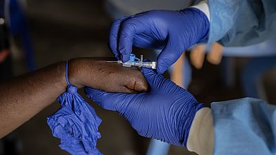 Africa CDC endorses Morocco's Mpox test