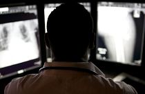 Researchers also found that physicians were more likely to trust an AI explanation if it pinpointed a specific area on an X-ray.