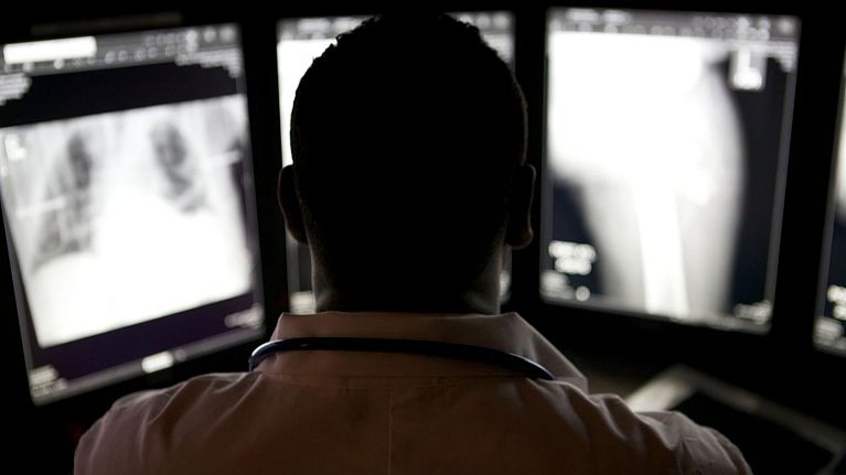 Researchers also found that physicians were more likely to trust an AI explanation if it pinpointed a specific area on an X-ray.