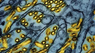 This colorised electron microscope image shows avian influenza A H5N1 virus particles (yellow), grown in Madin-Darby Canine Kidney (MDCK) epithelial cells (blue).