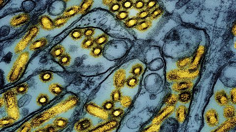 This colorised electron microscope image shows avian influenza A H5N1 virus particles (yellow), grown in Madin-Darby Canine Kidney (MDCK) epithelial cells (blue).