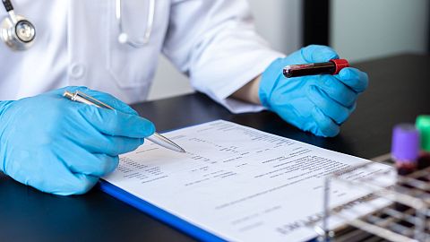 A doctor reviews a blood sample.