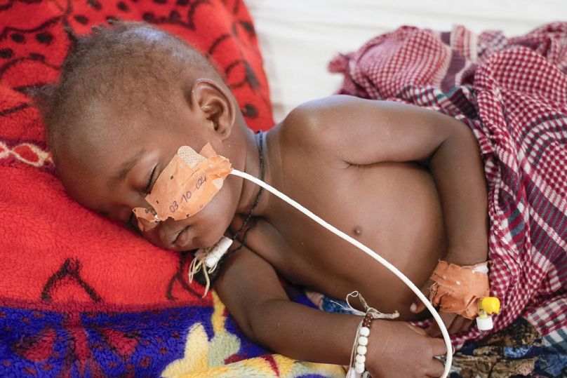 سلمى عيسى أبكر البالغة من العمر 17 شهرًا تستريح في عيادة تديرها منظمة أطباء بلا حدود في موقع أبوتنغي للنازحين بالقرب من عكا، تشاد، الجمعة 4 أكتوبر/تشرين الأول. 2024.