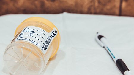 A urine testing cup is displayed.