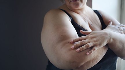 Italy unveils plans for a multi-million euro dedicated public fund to fight obesity