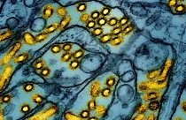 FILE -This colourized electron microscope image shows avian influenza A H5N1 virus particles (yellow), grown in Madin-Darby Canine Kidney (MDCK) epithelial cells (blue).