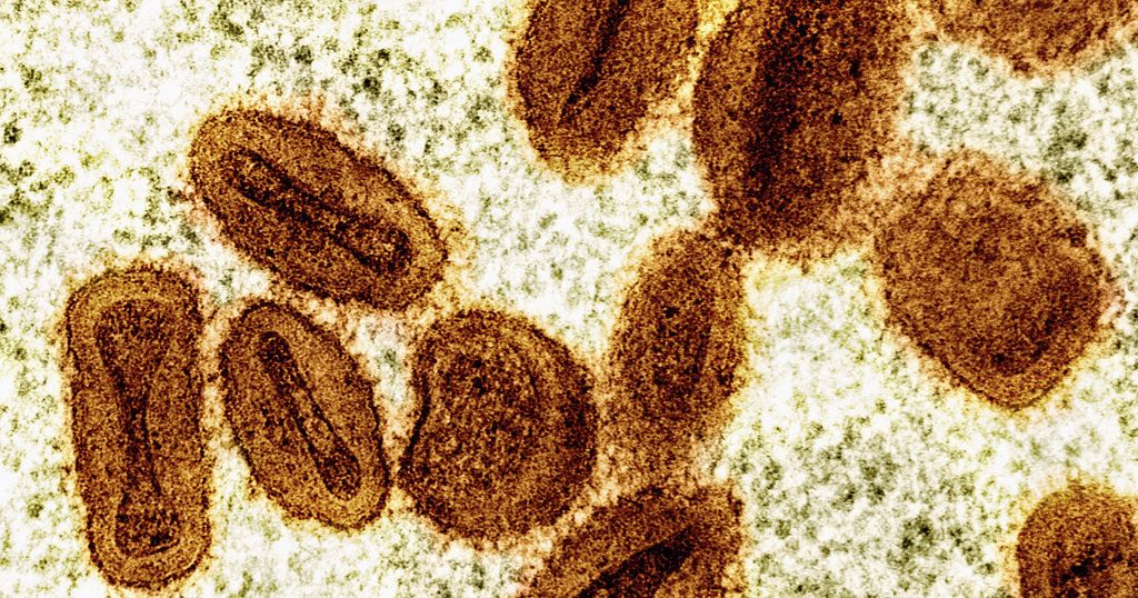 Kosovo reports first case of Mpox in traveler from West Africa