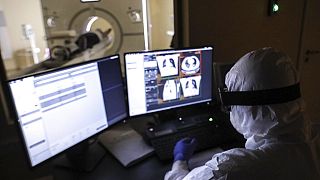 Despite having more oncology start-ups, Europe is falling behind in the development of high-growth cancer technologies.