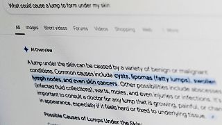 A health-related query on Google is displayed on a computer screen in April 2025.