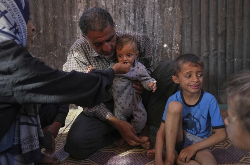 يعاني الطفل خالد، البالغ من العمر 9 أشهر، من ضعف حاد وجفاف شديد