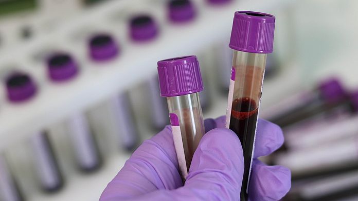 Alzheimer'ın kolay teşhisi için ilk kan testi onaylandı