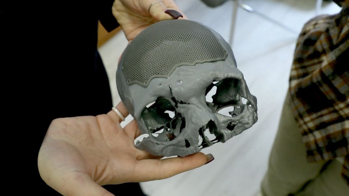 En Ukraine, cette clinique redonne un visage aux anciens soldats défigurés