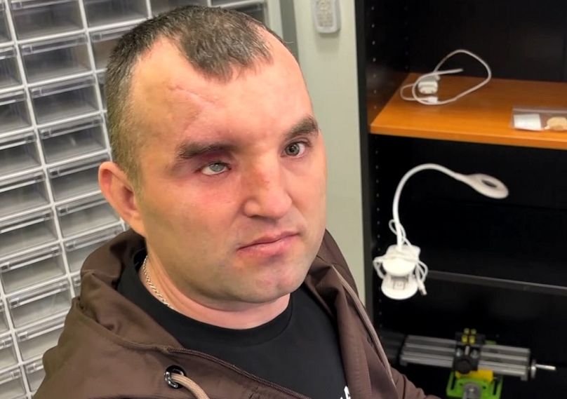 Iván Krivaltyuk, soldado herido de las Fuerzas Armadas de Ucrania.
