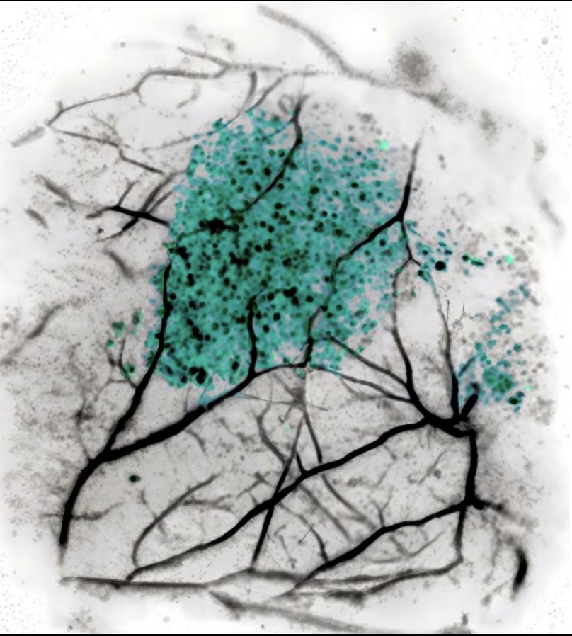 ‘I’ve got you under my skin: microplastics in mammalian tissue’, 2024. 