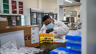 Santé : étude sur le microbiome intestinal en Afrique 